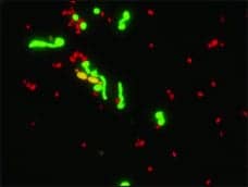 Molecular Diagnostics