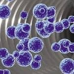 Mass Spectrometry: An Emerging Path for Clinical Diagnostics