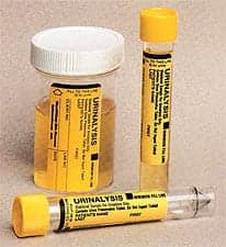 Urinalysis Products