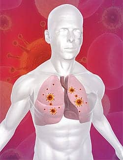 Shifting Standards in Respiratory Virus Diagnostics