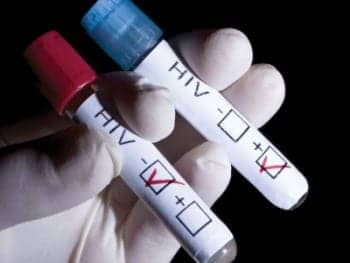 Testing for HIV and Other Sexually Transmitted DiseaseS