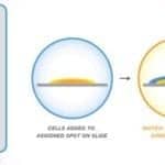 Mass Spectrometry’s Potential for Personalized Medicine