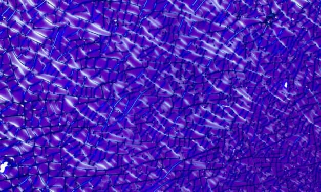 What Does a –<20 Result of a POC Microalbumin Test Mean? Is a Low Result Good or Bad?