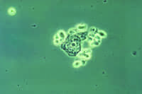 CLP STD trichomonas