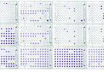 Biolog’s Phenotype MicroArray Technology Unlocks Autism Clue