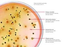 New Medium Detects Enteric Pathogens by Simple Color Change