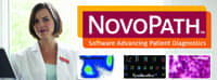 NovoPath fbCover-novopath