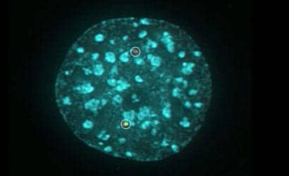 NIH Scientists Get First Look at How Cancer Chromosome Abnormalities Form in Living Cells