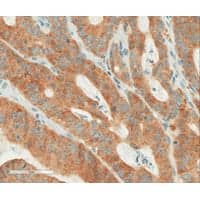 Ventana's New IHC Test Detects BRAF V600E Mutation | Clinical Lab Products