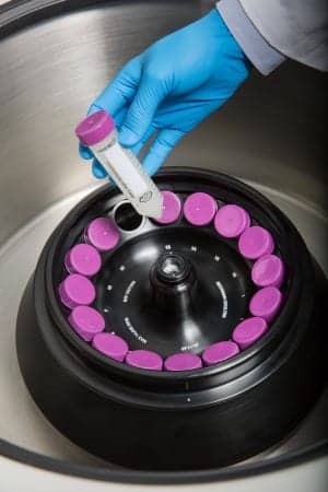 Centrifuge Rotors Deliver 14,000 RPM