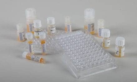 Sm Antigen for Use in Solid-Phase ELISA Tests