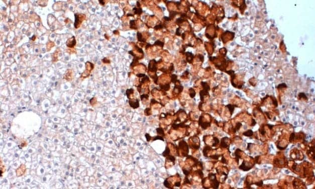 Hepatitis B Reagents