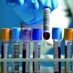 Right-Sizing Laboratory Automation