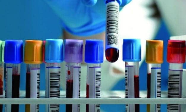 Right-Sizing Laboratory Automation