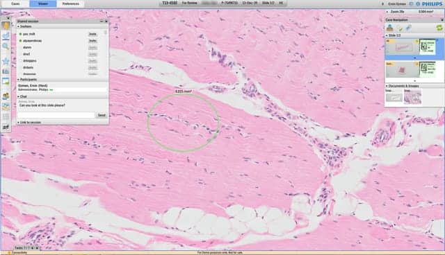 Digital Image Repository Aims to Unlock Pathology Data