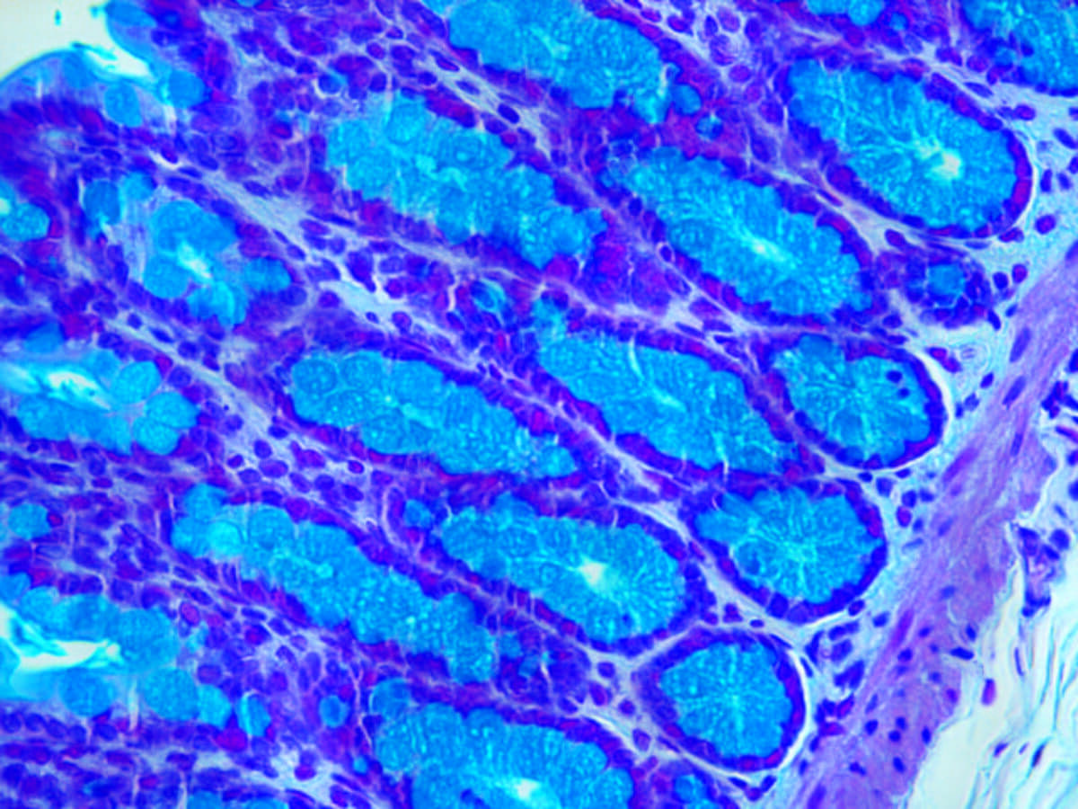 Histotechnology Takes Aim at Automation | Clinical Lab Products