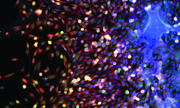 Companion Diagnostics for Cancer Immunotherapies