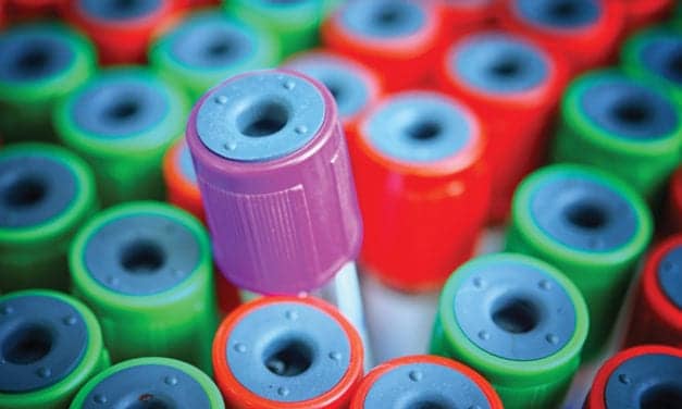 Veravas Launches VeraBIND Technology for Ultra-Sensitive Assays