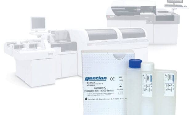 Cystatin C Assay Available on Beckman Coulter Chemistry and Immunochemistry Systems
