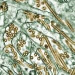 Quest Secures CDC Contracts for Testing Readiness of Avian Influenza and Oropouche Viruses