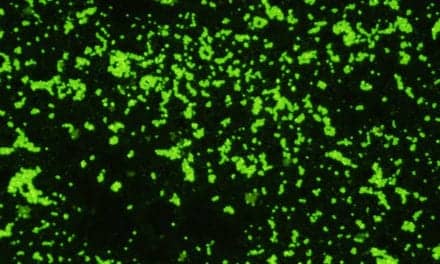 Rabbit Monoclonal Antibody to Group A Strep