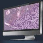 Pathology Goes Digital