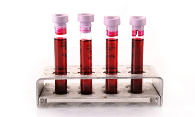 Clinical Specimen Panels Facilitate Assay Development