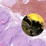 Software Aligns Brightfield, Fluorescence Whole Slide Images
