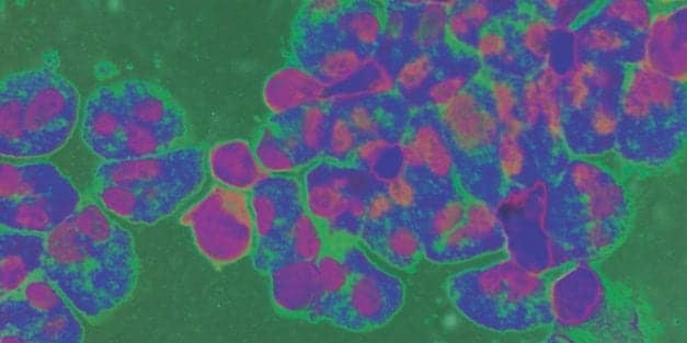 Cerebrospinal Fluid Testing