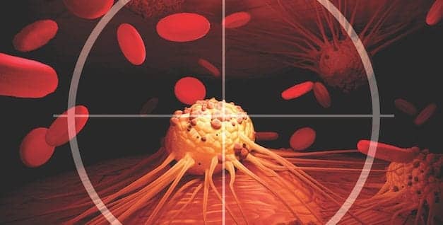 Adoption of Liquid Biopsy Tests for NSCLC