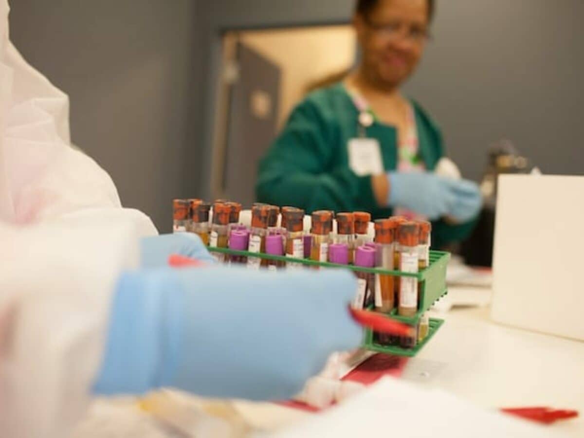 elfbar elfa master akku VAP Diagnostics Lab Relaunches Advanced Cholesterol Test