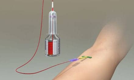 Peripheral Intravenous Catheter Addresses Blood Culture Contamination