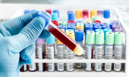 Blood Test Shows High Accuracy for Colorectal Cancer Detection