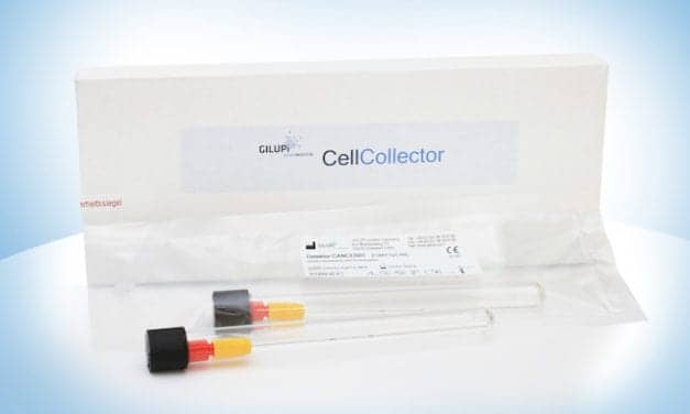 Combined Methods Show Promise for Early Detection of Lung Cancer