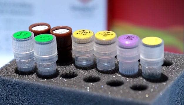 Seegene Uses AI System to Develop Multiplexed Molecular Diagnostics