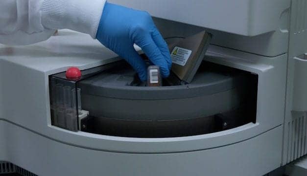 Prostate Health Test Shown to Reduce Biopsy Procedures