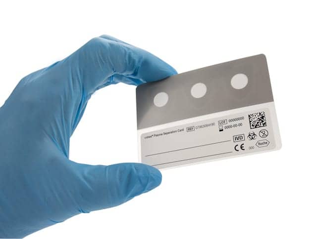 Roche Releases Sample Collection Device for HIV Plasma Viral Load Testing