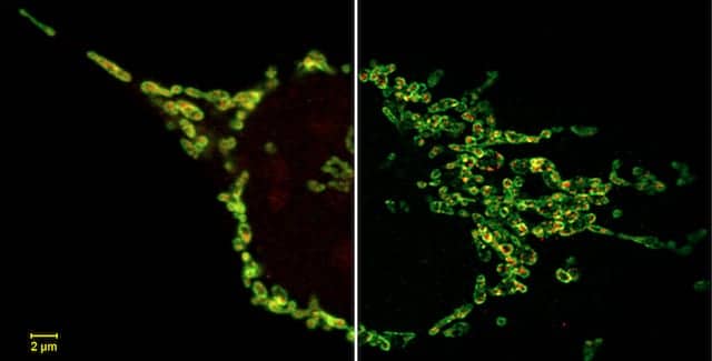 Laser-Scanning Microscope Delivers High Acquisition Speeds