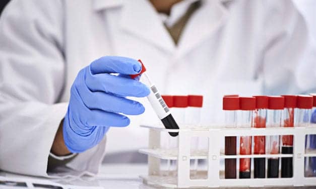 FDA Authorizes Marketing of Banyan Biomarkers Blood Test to Aid in the Evaluation of Concussion