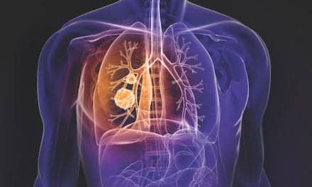 Overcoming Immune Blockade in Non-Small Cell Lung Cancer