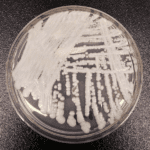 FDA Authorizes First Test to Identify the Emerging Pathogen Candida Auris