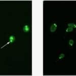 PerkinElmer Receives 510(k) Clearance for Crithidia luciliae Tests