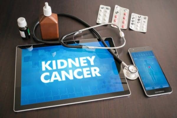 Kidney Cancer Study Puts Circulating Tumor DNA Assay to Test