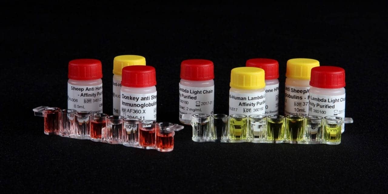 Binding Site Offers Native and Recombinant Mycoplasma Pneumoniae Antigens