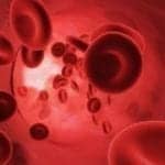 Mayo Medical Laboratories, National Decision Support Co Offer Comprehensive Approach to Patient Blood Management