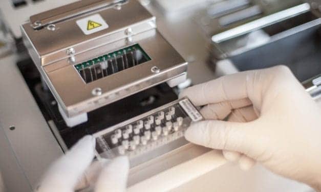 SenzaGen Launches First In Vitro Airway Allergy Test