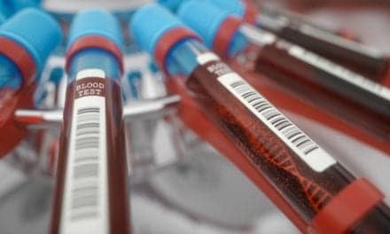 New Studies Support Blood Test for Early Detection of Alzheimer’s