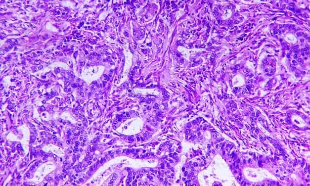 FDA Approves Roche CDx for Gastric and Gastroesophageal Junction Cancer Treatment