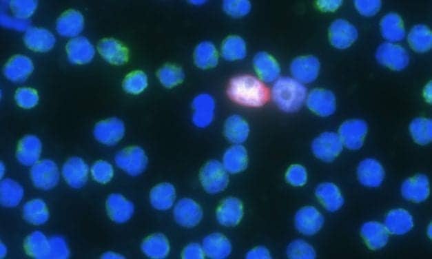 Blood Test May Identify Cancer Patients Who Respond to PSMA-Targeted Therapies