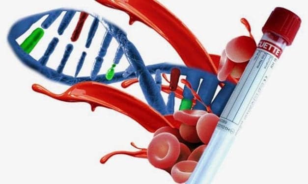 Precipio Launches HemeScreen Molecular Test for Hematologic Cancers